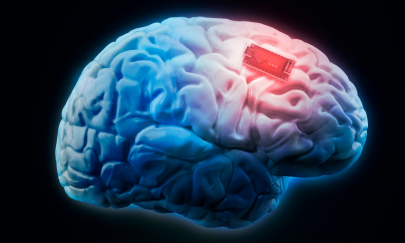 Серьезные проблемы нашли в мозговых чипах Neuralink